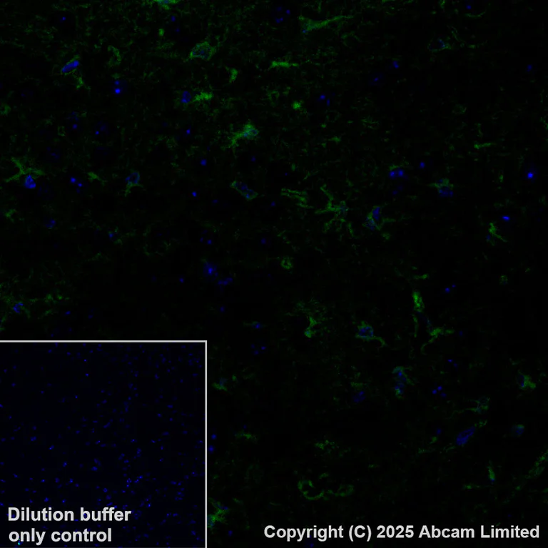 Immunohistochemistry (Formalin/PFA-fixed paraffin-embedded sections) - Alexa Fluor® 488 Anti-PADI2 / PAD2 antibody [EPR26940-85] (AB324331)
