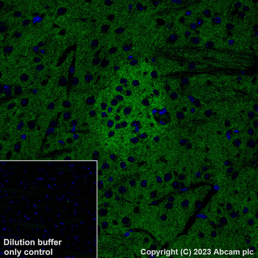 Immunohistochemistry (Formalin/PFA-fixed paraffin-embedded sections) - Alexa Fluor® 488 Anti-Pan Trk antibody [EPR17341] (AB308600), expandable thumbnail