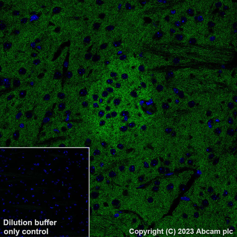 Immunohistochemistry (Formalin/PFA-fixed paraffin-embedded sections) - Alexa Fluor® 488 Anti-Pan Trk antibody [EPR17341] (AB308600)
