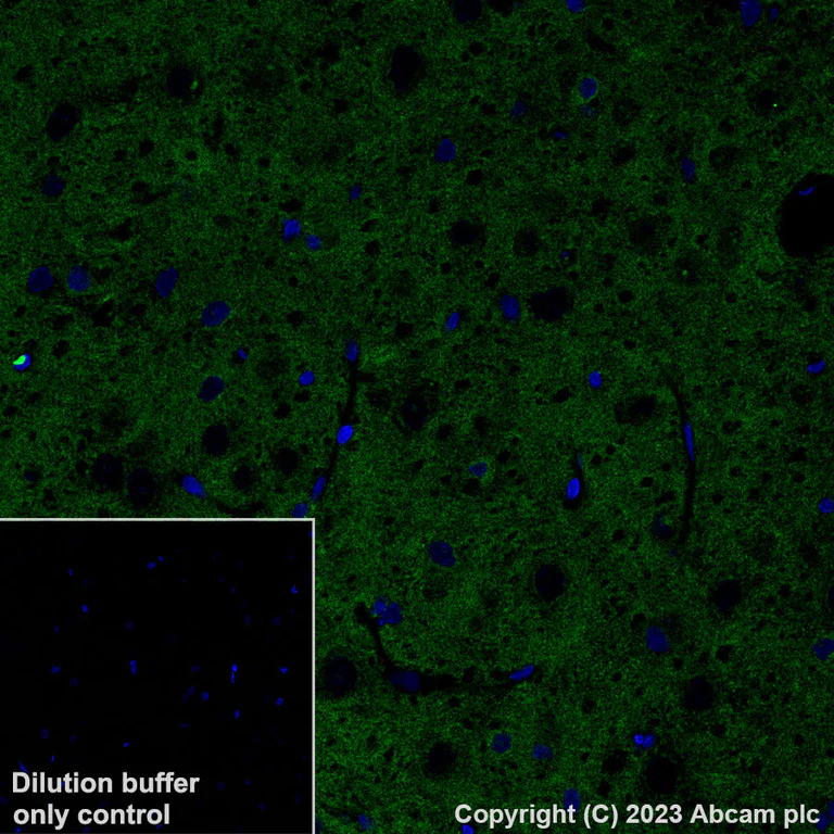Immunohistochemistry (Formalin/PFA-fixed paraffin-embedded sections) - Alexa Fluor® 488 Anti-Pan Trk antibody [EPR17341] (AB308600)