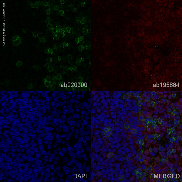 Immunohistochemistry (Frozen sections) - Alexa Fluor® 488 Anti-PD1 antibody [NAT105] (AB220300), expandable thumbnail