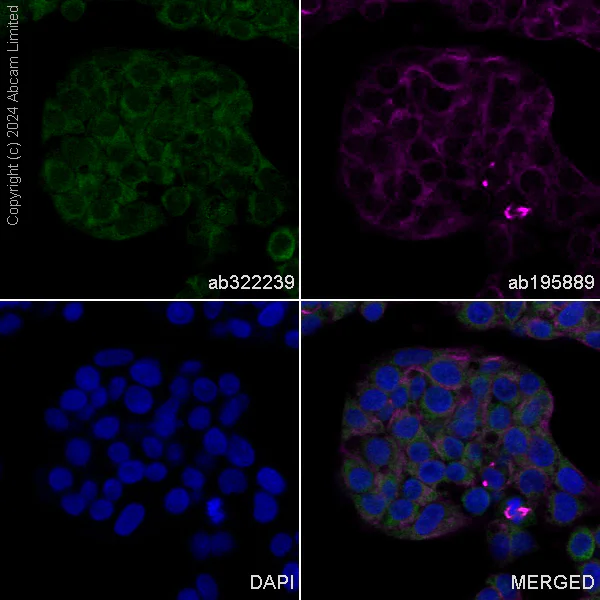Immunocytochemistry/ Immunofluorescence - Alexa Fluor® 488 Anti-Perilipin-1 antibody [EPR3753(2)] (AB322239)