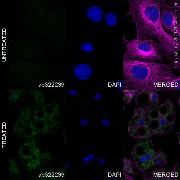 Immunocytochemistry/ Immunofluorescence - Alexa Fluor® 488 Anti-Perilipin-1 antibody [EPR3753(2)] (AB322239)
