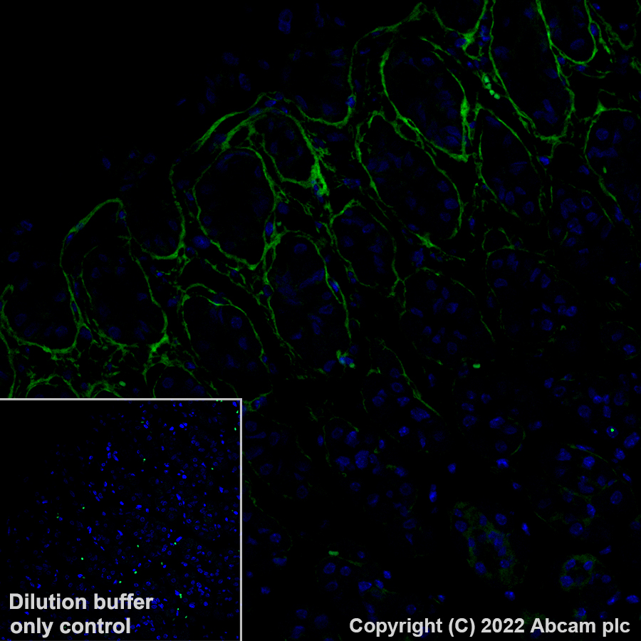 Immunohistochemistry (Formalin/PFA-fixed paraffin-embedded sections) - Alexa Fluor® 488 Anti-Periostin antibody [EPR20806] (AB306604), expandable thumbnail