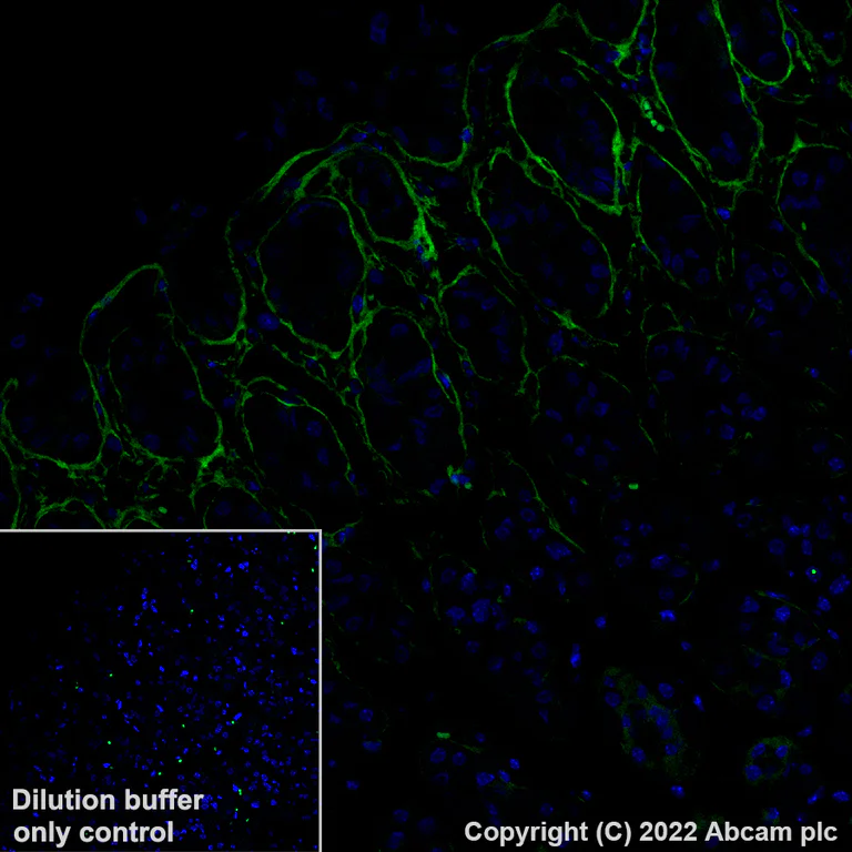 Immunohistochemistry (Formalin/PFA-fixed paraffin-embedded sections) - Alexa Fluor® 488 Anti-Periostin antibody [EPR20806] (AB306604)