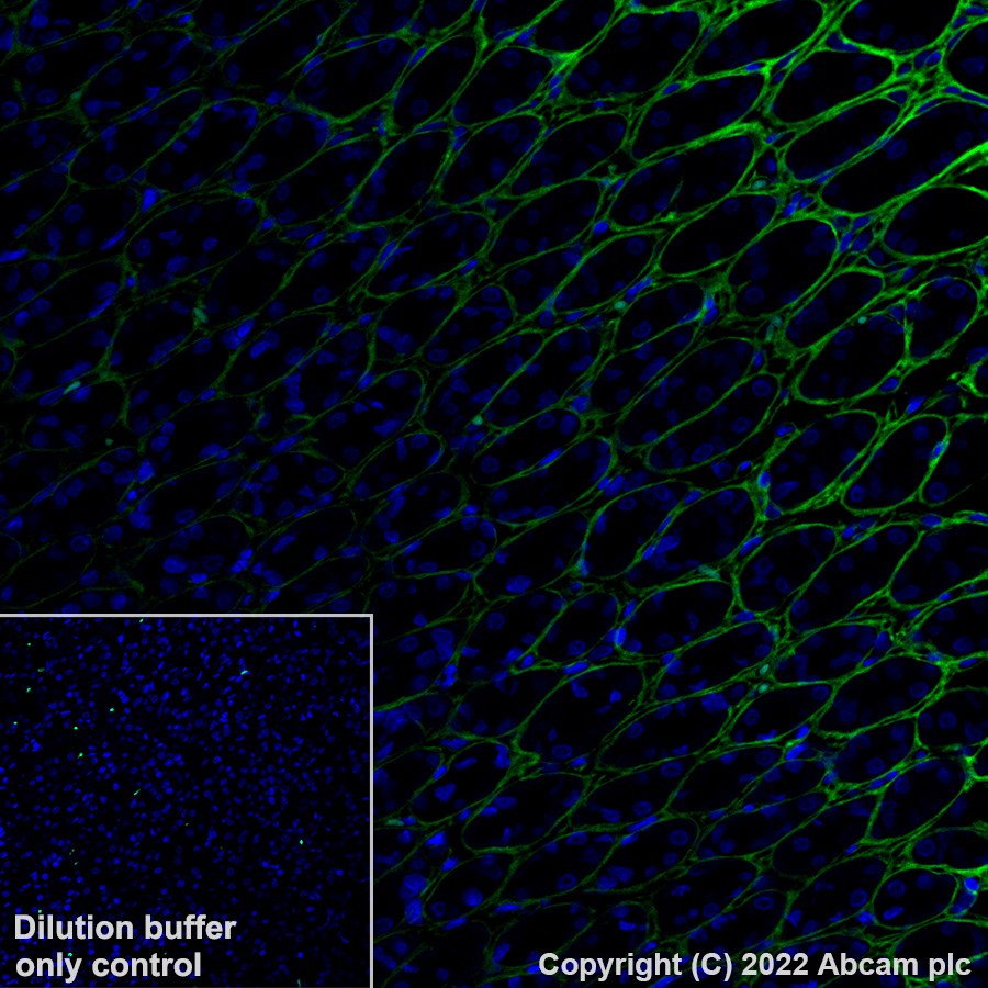 Immunohistochemistry (Formalin/PFA-fixed paraffin-embedded sections) - Alexa Fluor® 488 Anti-Periostin antibody [EPR20806] (AB306604), expandable thumbnail