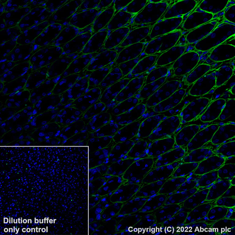 Immunohistochemistry (Formalin/PFA-fixed paraffin-embedded sections) - Alexa Fluor® 488 Anti-Periostin antibody [EPR20806] (AB306604)