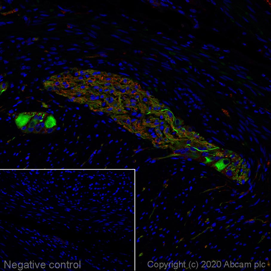 Immunohistochemistry (Formalin/PFA-fixed paraffin-embedded sections) - Alexa Fluor® 488 Anti-Peripherin antibody [EPR23445-28] (AB275150), expandable thumbnail
