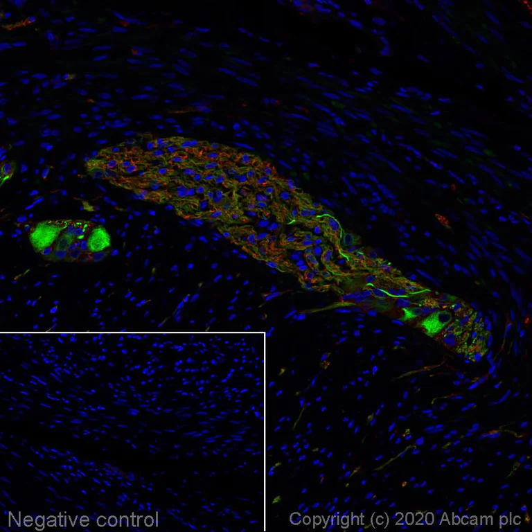Immunohistochemistry (Formalin/PFA-fixed paraffin-embedded sections) - Alexa Fluor® 488 Anti-Peripherin antibody [EPR23445-28] (AB275150)