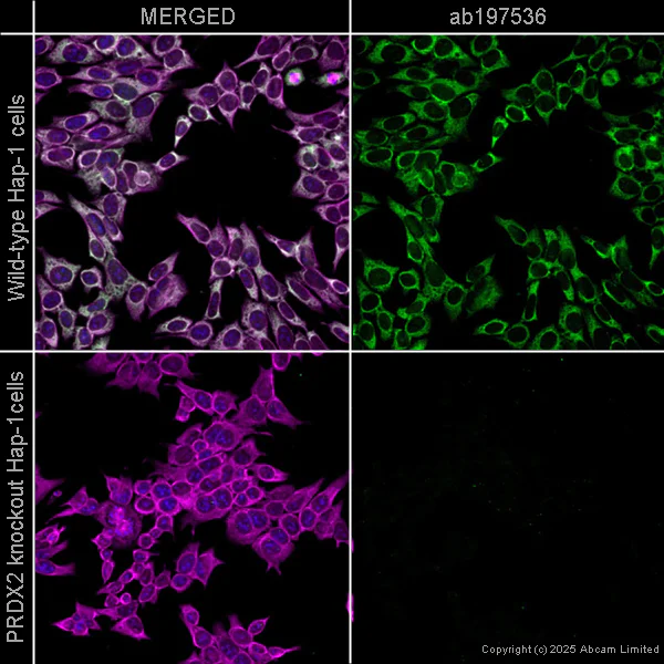 Immunocytochemistry/ Immunofluorescence - Alexa Fluor® 488 Anti-Peroxiredoxin 2/PRP antibody [EPR5154] (AB197536)