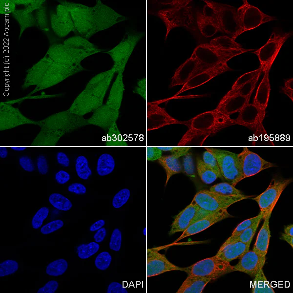 Immunocytochemistry - Alexa Fluor® 488 Anti-PGP9.5 antibody [EPR4118] - Neuronal Marker (AB302578)