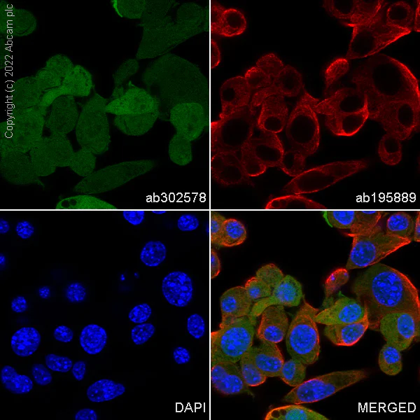 Anti-PGP9.5 - Neuronal Marker Alexa Fluor® 488 antibody [EPR4118