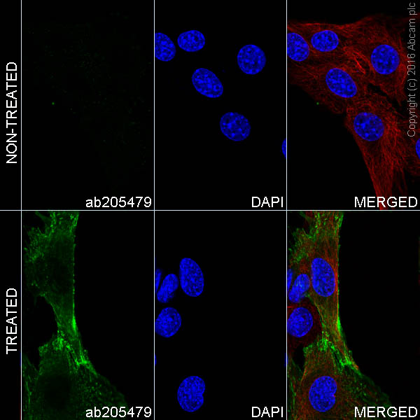 Immunocytochemistry/ Immunofluorescence - Alexa Fluor® 488 Anti-Phosphotyrosine antibody [EPR16871] (AB205479)
