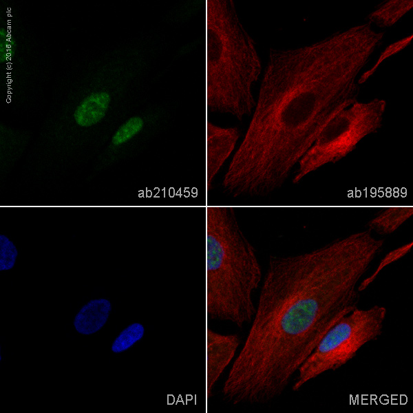 Immunocytochemistry/ Immunofluorescence - Alexa Fluor® 488 Anti-PHOX2B antibody [EPR14423] - C-terminal (AB210459), expandable thumbnail