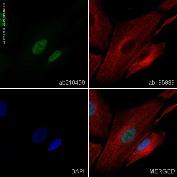 Immunocytochemistry/ Immunofluorescence - Alexa Fluor® 488 Anti-PHOX2B antibody [EPR14423] - C-terminal (AB210459)