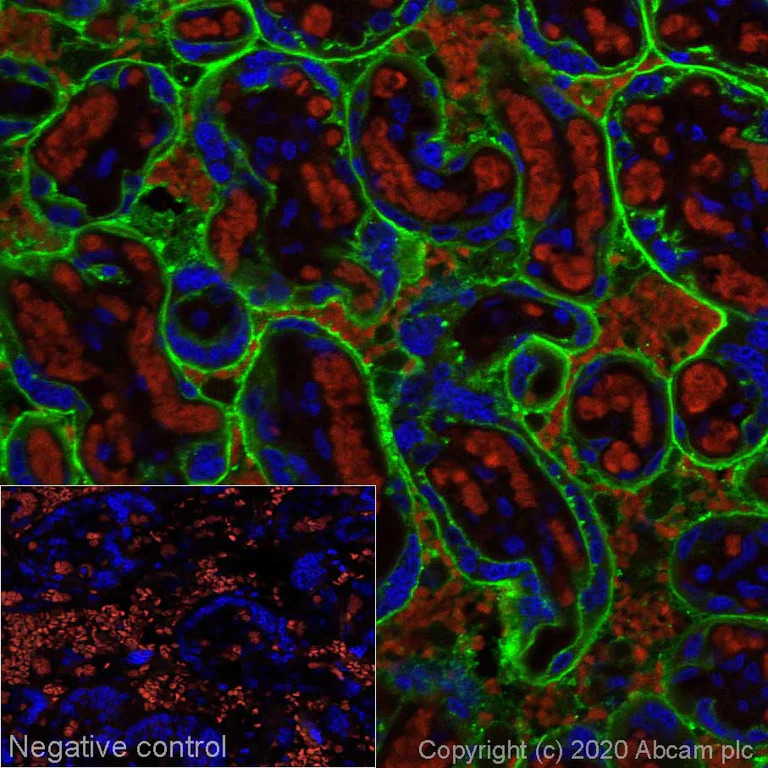 Immunohistochemistry (Formalin/PFA-fixed paraffin-embedded sections) - Alexa Fluor® 488 Anti-Placental alkaline phosphatase (PLAP) antibody [SP15] (AB270195)
