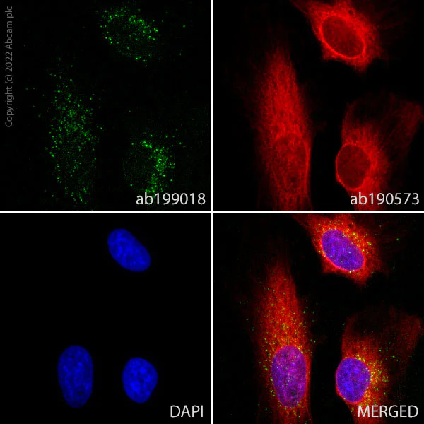 Immunocytochemistry/ Immunofluorescence - Alexa Fluor® 488 Anti-PMP70 antibody [EPR5614] (AB199018)