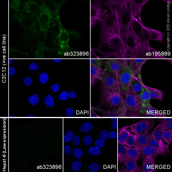 Immunocytochemistry/ Immunofluorescence - Alexa Fluor® 488 Anti-Podoplanin antibody [EPR27193-535] (AB323896)