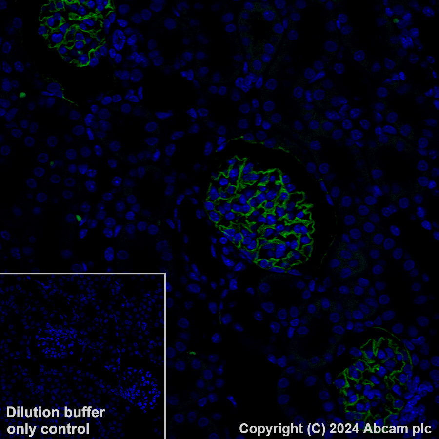 Immunohistochemistry (Formalin/PFA-fixed paraffin-embedded sections) - Alexa Fluor® 488 Anti-Podoplanin antibody [PMab-1] (AB318248), expandable thumbnail