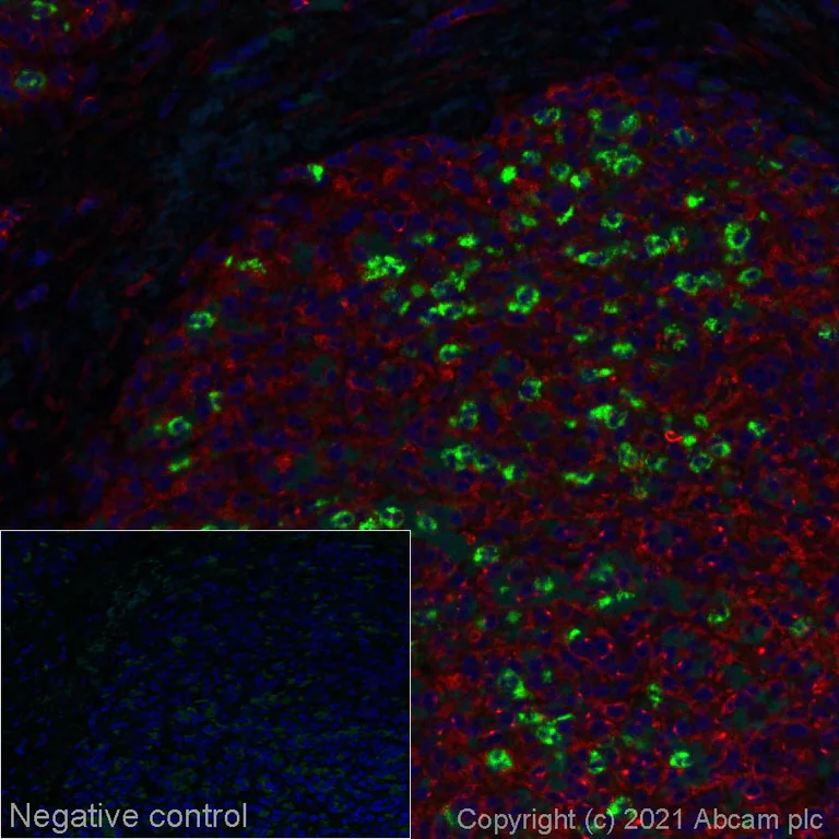 Immunohistochemistry (Formalin/PFA-fixed paraffin-embedded sections) - Alexa Fluor® 488 Anti-PR3 antibody [EPR23253-35] (AB282665)