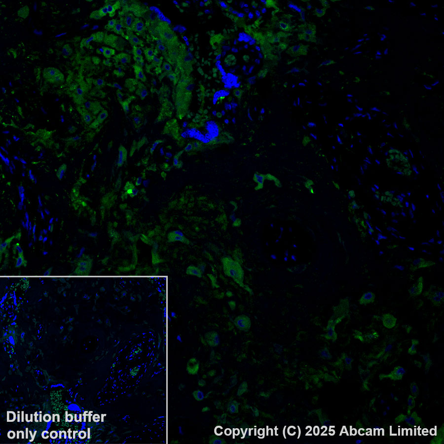 Immunohistochemistry (Formalin/PFA-fixed paraffin-embedded sections) - Alexa Fluor® 488 Anti-PRG2 antibody [EPR29096-502] (AB324073), expandable thumbnail