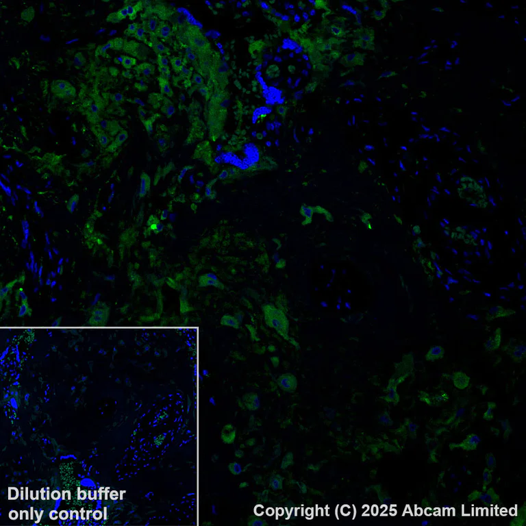 Immunohistochemistry (Formalin/PFA-fixed paraffin-embedded sections) - Alexa Fluor® 488 Anti-PRG2 antibody [EPR29096-502] (AB324073)