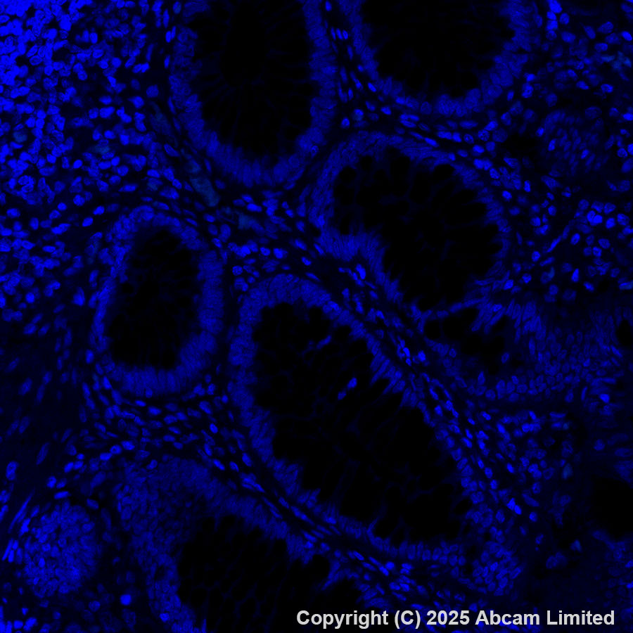 Immunohistochemistry (Formalin/PFA-fixed paraffin-embedded sections) - Alexa Fluor® 488 Anti-PRG2 antibody [EPR29096-502] (AB324073), expandable thumbnail
