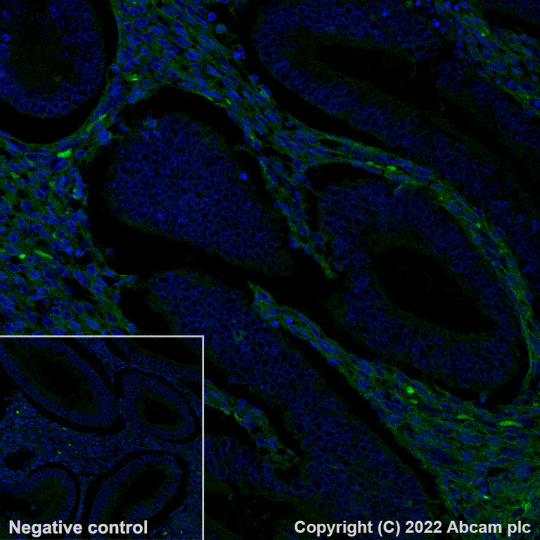 Immunohistochemistry - Alexa Fluor® 488 Anti-Pro-Collagen III Alpha 1 antibody [EPR24255-13] (AB300097)