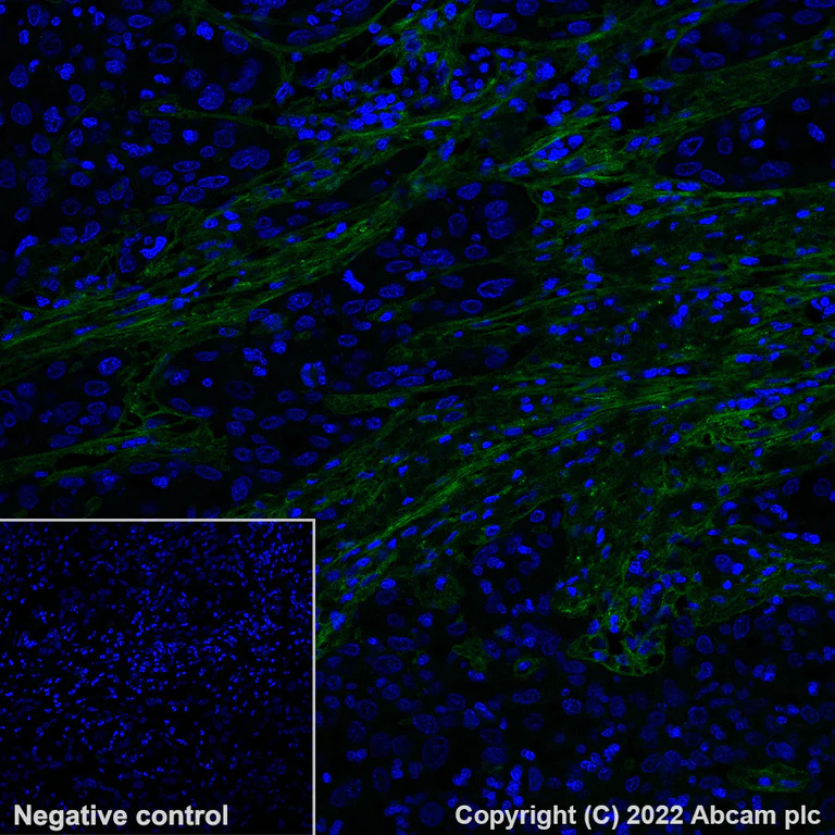 Immunohistochemistry - Alexa Fluor® 488 Anti-Pro-Collagen III Alpha 1 antibody [EPR24255-13] (AB300097)