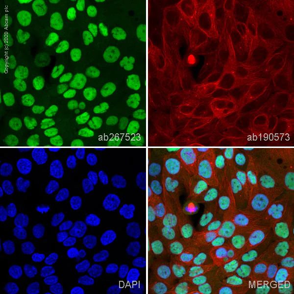 Immunocytochemistry/ Immunofluorescence - Alexa Fluor® 488 Anti-Progesterone Receptor antibody [SP2] (AB267523)