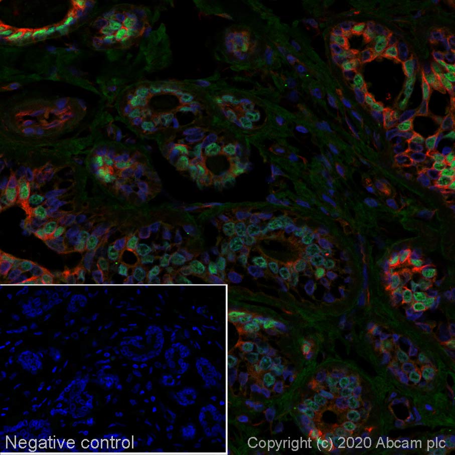 Immunohistochemistry (Formalin/PFA-fixed paraffin-embedded sections) - Alexa Fluor® 488 Anti-Progesterone Receptor antibody [SP2] (AB267523)
