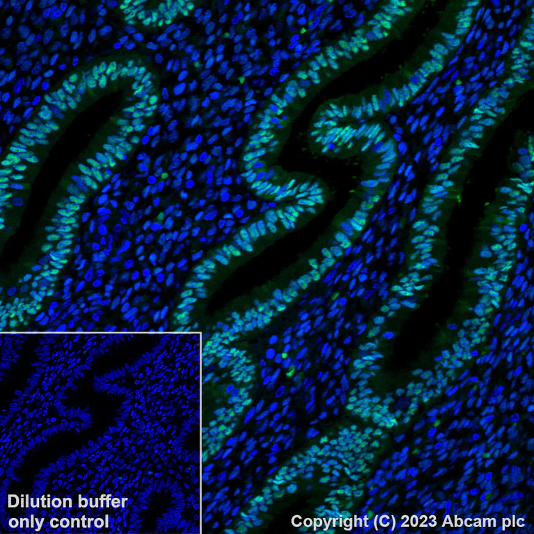 Immunohistochemistry (Formalin/PFA-fixed paraffin-embedded sections) - Alexa Fluor® 488 Anti-Progesterone Receptor antibody [YR85] (AB313737)