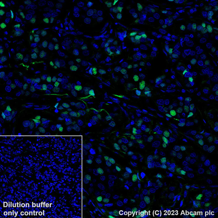 Immunohistochemistry (Formalin/PFA-fixed paraffin-embedded sections) - Alexa Fluor® 488 Anti-Progesterone Receptor antibody [YR85] (AB313737)