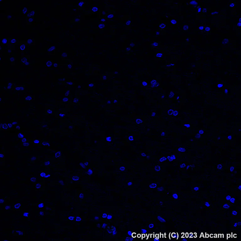 Immunohistochemistry (Formalin/PFA-fixed paraffin-embedded sections) - Alexa Fluor® 488 Anti-Progesterone Receptor antibody [YR85] (AB313737)