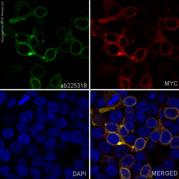 Immunocytochemistry/ Immunofluorescence - Alexa Fluor® 488 Anti-Prolactin/PRL antibody [EPR19386] (AB225318)