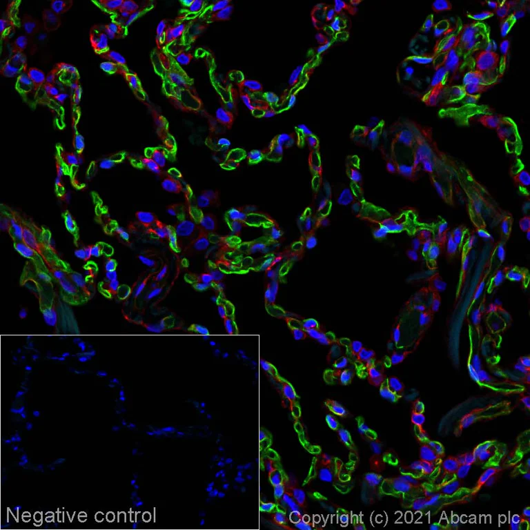 Immunohistochemistry (Formalin/PFA-fixed paraffin-embedded sections) - Alexa Fluor® 488 Anti-PRX antibody [EPR24150-36] (AB282661)