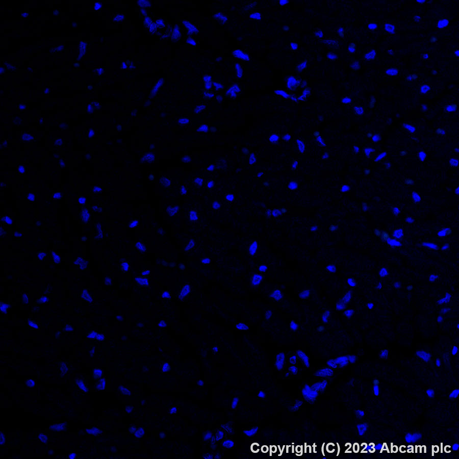 Immunohistochemistry (Formalin/PFA-fixed paraffin-embedded sections) - Alexa Fluor® 488 Anti-PSMA antibody [EPR6253] (AB309608)