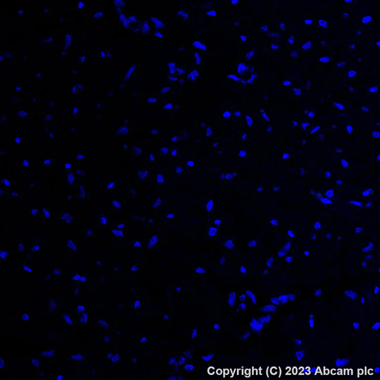 Immunohistochemistry (Formalin/PFA-fixed paraffin-embedded sections) - Alexa Fluor® 488 Anti-PSMA antibody [EPR6253] (AB309608)