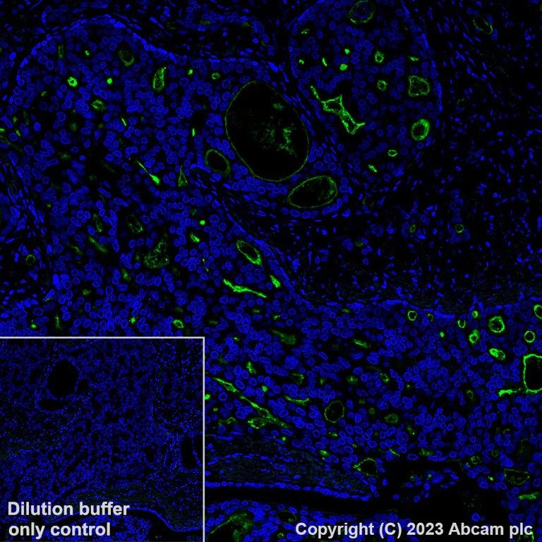 Immunohistochemistry (Formalin/PFA-fixed paraffin-embedded sections) - Alexa Fluor® 488 Anti-PSMA antibody [EPR6253] (AB309608)