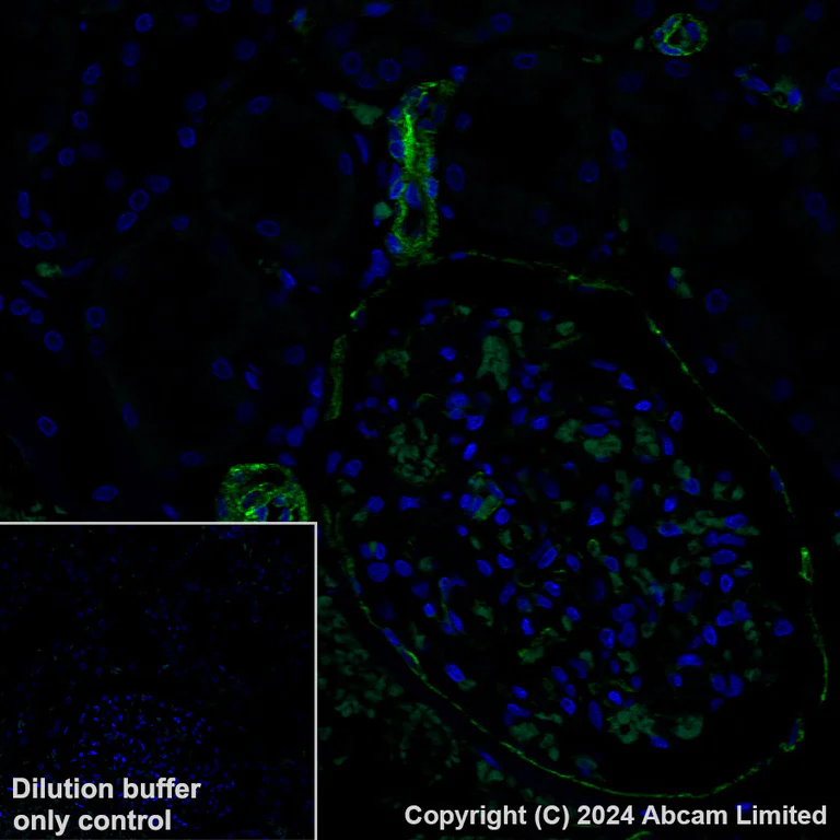 Immunohistochemistry (Formalin/PFA-fixed paraffin-embedded sections) - Alexa Fluor® 488 Anti-PTRF antibody [EPR27006-67] (AB320701)