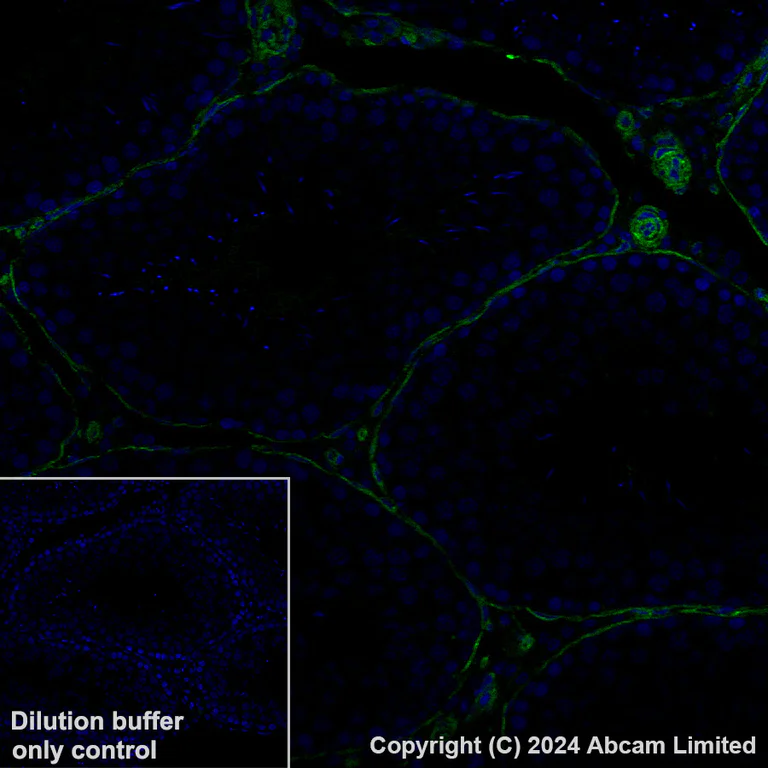 Immunohistochemistry (Formalin/PFA-fixed paraffin-embedded sections) - Alexa Fluor® 488 Anti-PTRF antibody [EPR27006-67] (AB320701)