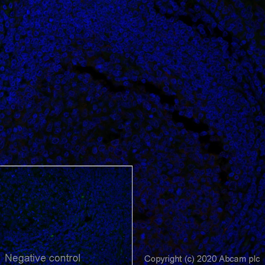 Immunohistochemistry (Formalin/PFA-fixed paraffin-embedded sections) - Alexa Fluor® 488 Anti-Rabbit IgG antibody [SP137] (AB270142), expandable thumbnail