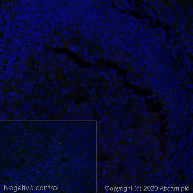 Immunohistochemistry (Formalin/PFA-fixed paraffin-embedded sections) - Alexa Fluor® 488 Anti-Rabbit IgG antibody [SP137] (AB270142)