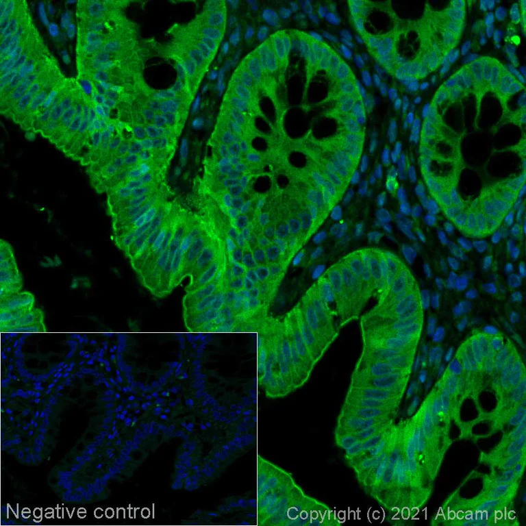 Anti-Ras Alexa Fluor® 488 antibody [EPR23474-20] (ab281755) IgG | Abcam