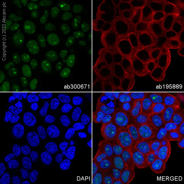 Immunocytochemistry/ Immunofluorescence - Alexa Fluor® 488 Anti-Rb antibody [EPR17512] (AB300671)