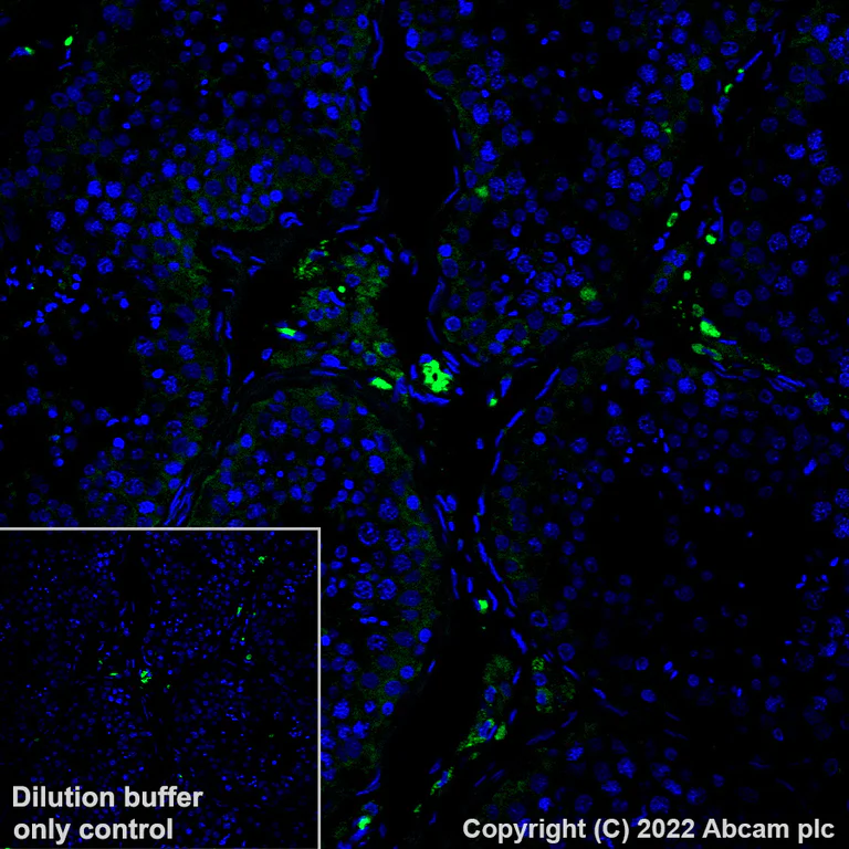 Immunohistochemistry (Formalin/PFA-fixed paraffin-embedded sections) - Alexa Fluor® 488 Anti-ROCK1 antibody [EPR638Y] (AB307864)