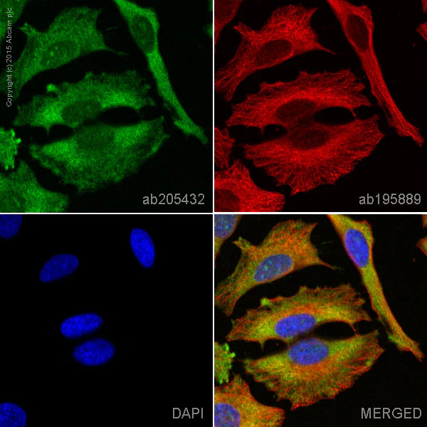 Immunocytochemistry/ Immunofluorescence - Alexa Fluor® 488 Anti-ROCK2 + ROCK1 antibody [EP786Y] (AB205432)