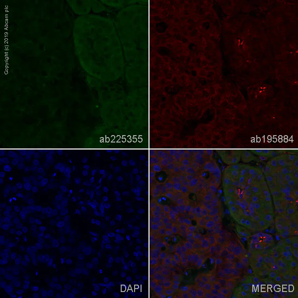 Immunohistochemistry (Formalin/PFA-fixed paraffin-embedded sections) - Alexa Fluor® 488 Anti-ROS1 antibody [EPMGHR2] (AB225355)
