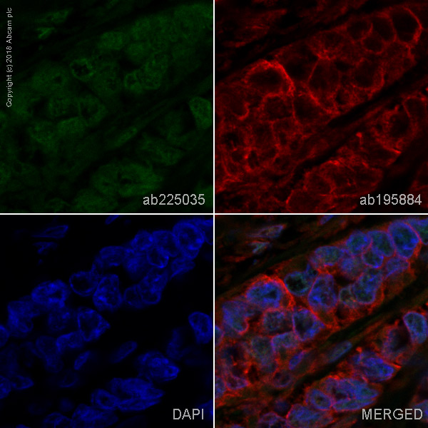 Immunohistochemistry (Formalin/PFA-fixed paraffin-embedded sections) - Alexa Fluor® 488 Anti-RPA32/RPA2 antibody [EPR2877Y] (AB225035), expandable thumbnail