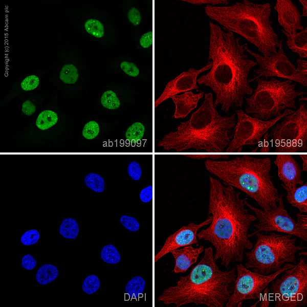 Immunocytochemistry/ Immunofluorescence - Alexa Fluor® 488 Anti-RPA70 antibody [EPR3472] (AB199097)